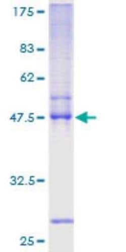 Novus Biologicals Recombinant Human Twist-2 GST (N-Term) Protein 10 &mu;g | Buy Online | Novus Biologicals&trade; | Fisher Scientific