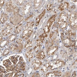Two pore calcium channel protein 2 Antibody, Novus Biologicals 0.1mL; Unlabeled:Antibodies,
