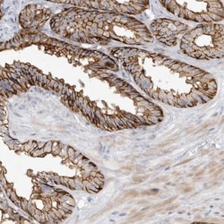 Two pore calcium channel protein 2 Antibody, Novus Biologicals 0.1mL; Unlabeled:Antibodies,