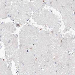 Two pore calcium channel protein 2 Antibody, Novus Biologicals 0.1mL; Unlabeled:Antibodies,