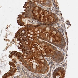 Tyk2 Antibody, Novus Biologicals:Antibodies:Primary Antibodies