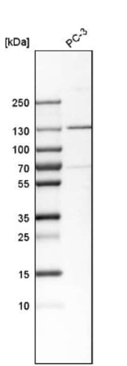 Tyk2 Antibody, Novus Biologicals:Antibodies:Primary Antibodies