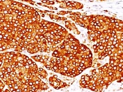 Tyrosinase Antibody (T311 + OCA1/812), Novus Biologicals 0.2mg; Unlabeled:Antibodies,
