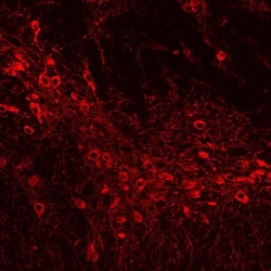 Tyrosine Hydroxylase Antibody, Novus Biologicals 0.025mL; Unlabeled:Antibodies,