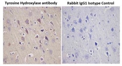 Tyrosine Hydroxylase Antibody, Novus Biologicals 0.1mL; Unlabeled:Antibodies,