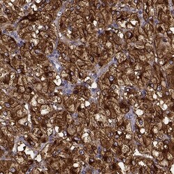 Tyrosine Hydroxylase Antibody, Novus Biologicals:Antibodies:Primary Antibodies