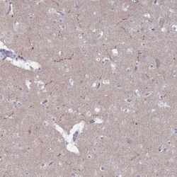 Tyrosine Hydroxylase Antibody, Novus Biologicals:Antibodies:Primary Antibodies