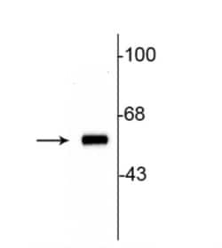 Tyrosine Hydroxylase Antibody, Novus Biologicals 0.1mL; Unlabeled:Antibodies,