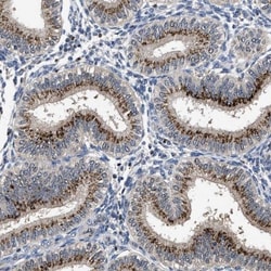 Tyrosylprotein Sulfotransferase 2/TPST2 Antibody, Novus Biologicals 0.1mL;