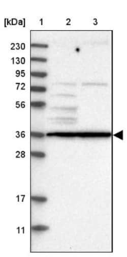Tyrosylprotein Sulfotransferase 2/TPST2 Antibody, Novus Biologicals 0.1mL;