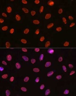 U1A Rabbit anti-Human, Mouse, Rat, Clone: 8I3P5, Novus Biologicals 20 &mu;g;