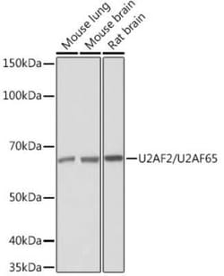 U2AF2 Rabbit anti-Human, Mouse, Rat, Clone: 8E8R9, Novus Biologicals 100