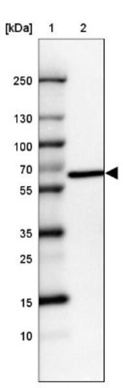 U2AF2 Antibody, Novus Biologicals 0.1mL; Unlabeled:Antibodies, Polyclonal