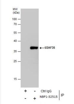 U2AF35 Antibody, Novus Biologicals 0.1mL; Unlabeled:Antibodies, Polyclonal