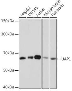UAP1 Rabbit anti-Human, Mouse, Rat, Clone: 5S7M2, Novus Biologicals 100 &mu;g | Buy Online | Novus Biologicals | Fisher Scientific