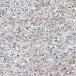 UAP1 Antibody, Novus Biologicals 0.1mL; Unlabeled:Antibodies, Polyclonal