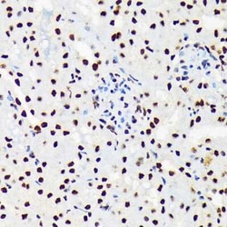 UAP56 Rabbit anti-Human, Mouse, Rat, Clone: 4A0Q2, Novus Biologicals 100