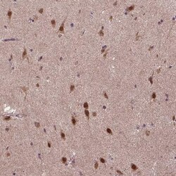 UBA3 Antibody, Novus Biologicals:Antibodies:Primary Antibodies