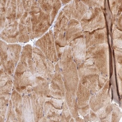 UBE2G1 Antibody, Novus Biologicals 0.1 mL | Buy Online | Novus Biologicals | Fisher Scientific