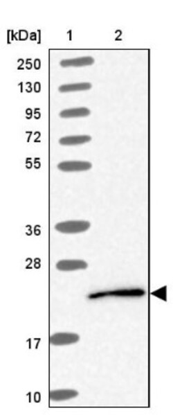 UBE2G1 Antibody, Novus Biologicals 0.1 mL | Buy Online | Novus Biologicals | Fisher Scientific