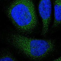 TOP1MT Antibody, Novus Biologicals:Antibodies:Primary Antibodies