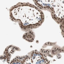 TOP1MT Antibody, Novus Biologicals:Antibodies:Primary Antibodies