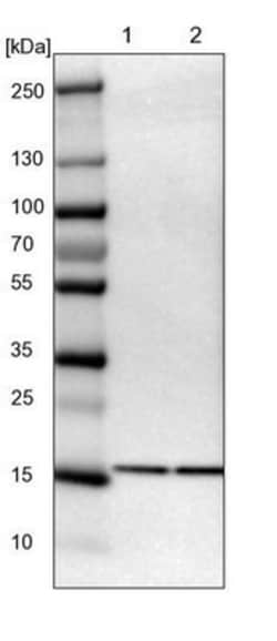 TOP1MT Antibody, Novus Biologicals:Antibodies:Primary Antibodies