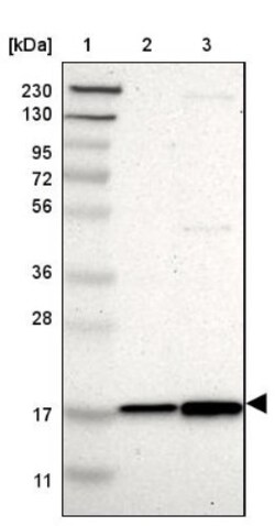 TOP1MT Antibody, Novus Biologicals:Antibodies:Primary Antibodies
