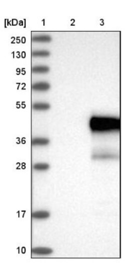 UBE2J1 Antibody, Novus Biologicals:Antibodies:Primary Antibodies
