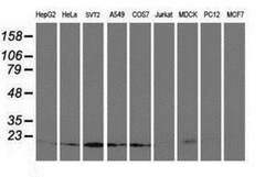 UBE2M/Ubc12 Antibody (OTI2D9), Novus Biologicals 0.1 mL | Buy Online | Novus Biologicals | Fisher Scientific