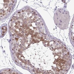 UBE2S Antibody, Novus Biologicals 25 &mu;L, Unlabeled:Antibodies, Polyclonal