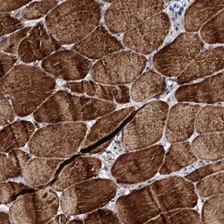 UBE3C Antibody, Novus Biologicals:Antibodies:Primary Antibodies