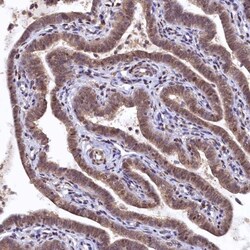 UBL7 Antibody, Novus Biologicals:Antibodies:Primary Antibodies
