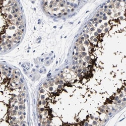 BCL2L12 Antibody, Novus Biologicals:Antibodies:Primary Antibodies