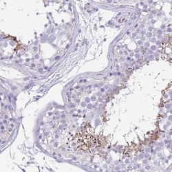 UBQLN3 Antibody, Novus Biologicals 0.1mL; Unlabeled:Antibodies, Polyclonal