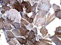 UBR1 Antibody, Novus Biologicals 100 &mu;g; Unconjugated:Antibodies, Polyclonal