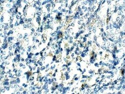 UBR1 Antibody, Novus Biologicals 100 &mu;g; Unconjugated:Antibodies, Polyclonal