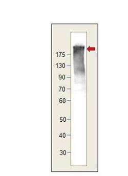 UBR1 Antibody, Novus Biologicals 100 &mu;g; Unconjugated:Antibodies, Polyclonal
