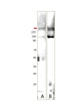 UBR1 Antibody, Novus Biologicals 100 &mu;g; Unconjugated:Antibodies, Polyclonal