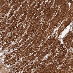 UBR2 Antibody, Novus Biologicals:Antibodies:Primary Antibodies
