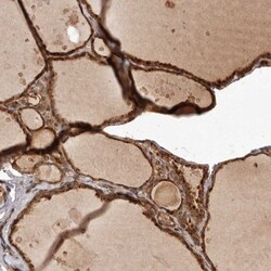 UBR2 Antibody, Novus Biologicals:Antibodies:Primary Antibodies
