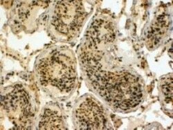 UBR5/EDD Antibody, Novus Biologicals 0.1mg; Unlabeled:Antibodies, Polyclonal