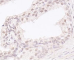 UBR5/EDD Antibody, Novus Biologicals 100 &mu;L | Buy Online | Novus Biologicals | Fisher Scientific