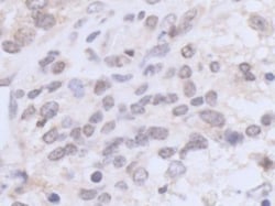 UBR5/EDD Antibody, Novus Biologicals 100 &mu;L | Buy Online | Novus Biologicals | Fisher Scientific