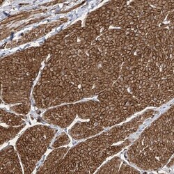 UBTD1 Antibody, Novus Biologicals:Antibodies:Primary Antibodies
