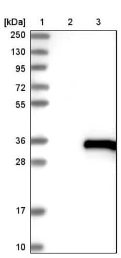 UBTD1 Antibody, Novus Biologicals:Antibodies:Primary Antibodies