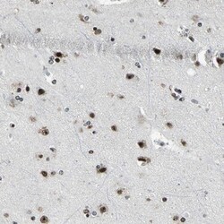 UBTF Antibody, Novus Biologicals 0.1 mL | Buy Online | Novus Biologicals | Fisher Scientific