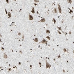 UBTF Antibody, Novus Biologicals 0.1 mL | Buy Online | Novus Biologicals | Fisher Scientific