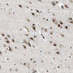 UBTF Antibody, Novus Biologicals 0.1 mL | Buy Online | Novus Biologicals | Fisher Scientific