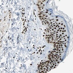 UBTF Antibody, Novus Biologicals 0.1 mL | Buy Online | Novus Biologicals | Fisher Scientific